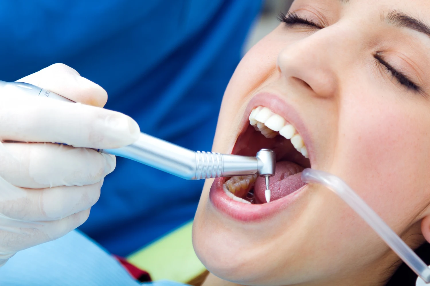 wisdom teeth removal recovery guide